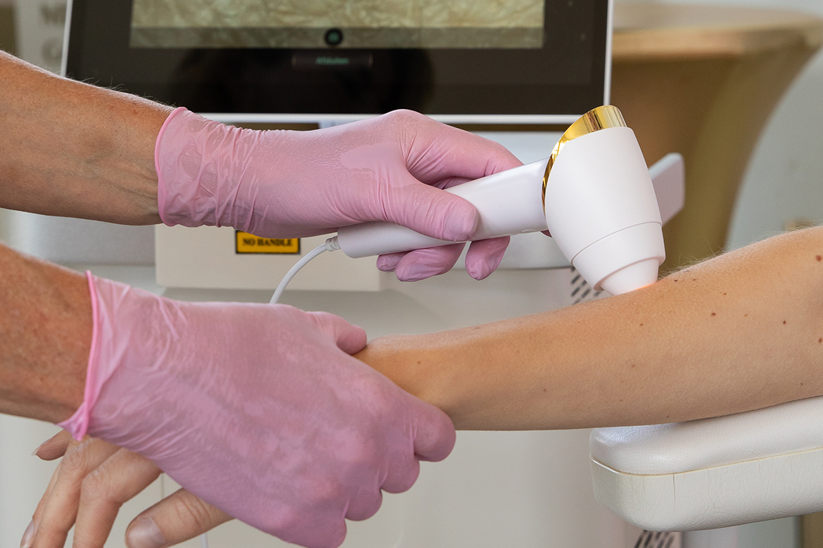 Laserbehandeling naar keuze bij Luxe Diode Laser