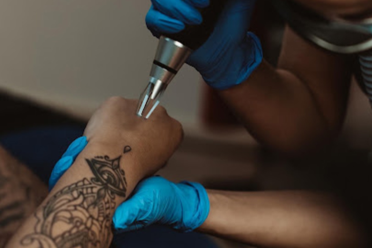 Tatoeage verwijderen bij Heesakkers Beauty 